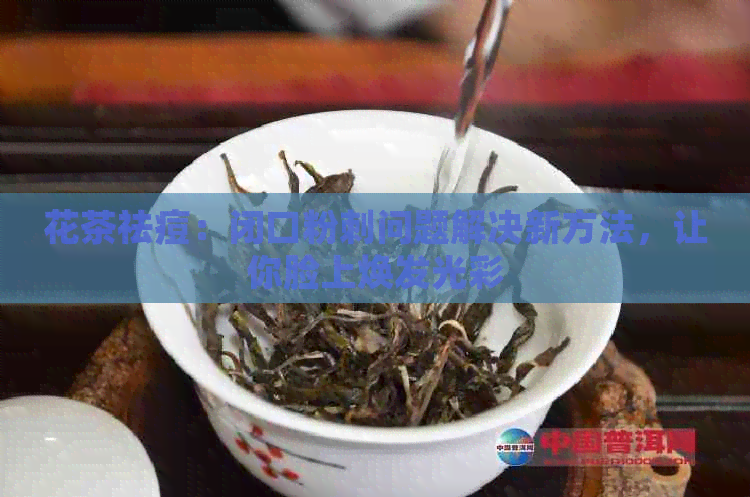 花茶祛痘：闭口粉刺问题解决新方法，让你脸上焕发光彩