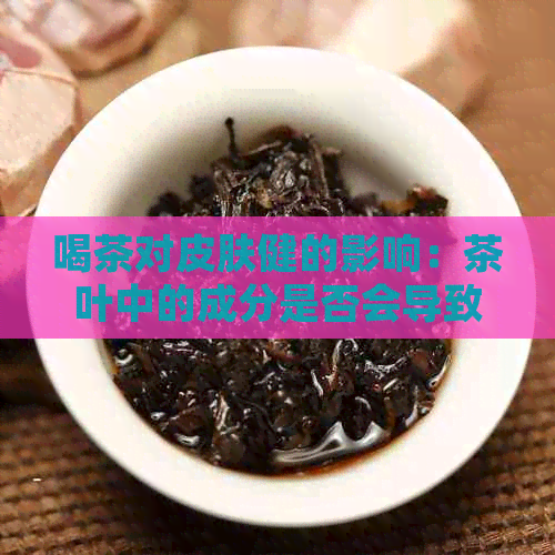 喝茶对皮肤健的影响：茶叶中的成分是否会导致脸色变黄？