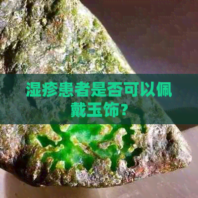 湿疹患者是否可以佩戴玉饰？